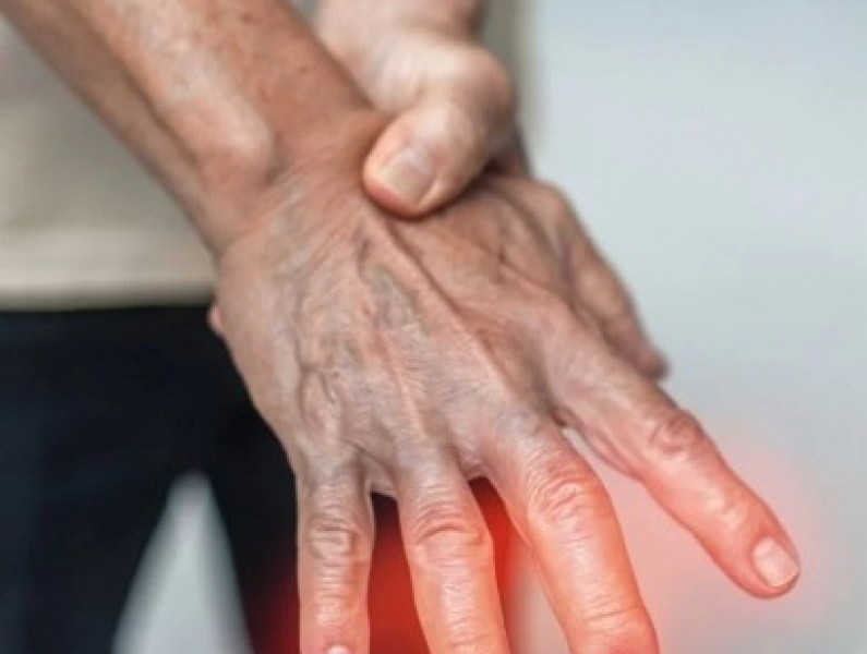 arthritis3
